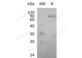 Recombinant Human Lactotransferrin/LTF Protein (His Tag) - ABMIUM