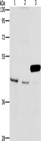 Anti-Human/Mouse/Rat ARMCX3 Antibody - ABMIUM