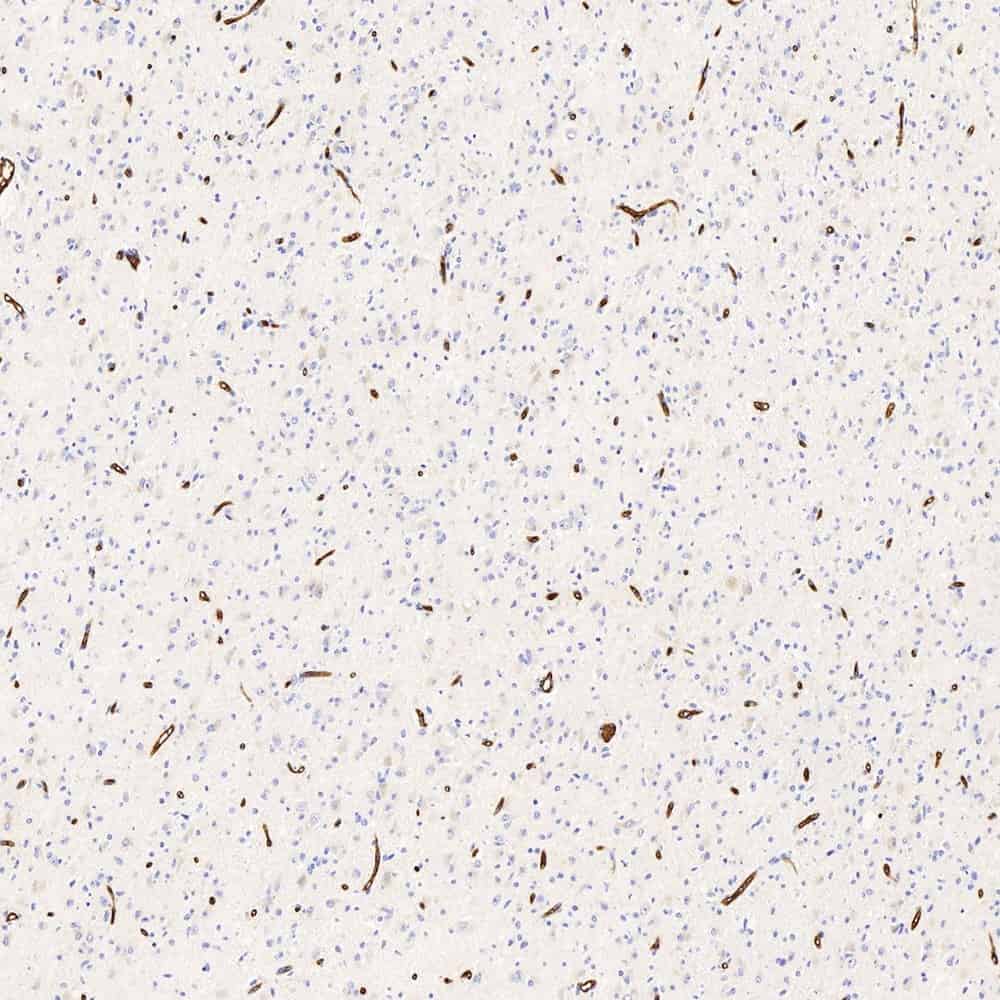 Immunohistochemistry analysis of paraffin-embedded human brain using GLUT-1 Polyclonal Antibody at dilution of 1:300.