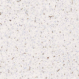 Immunohistochemistry analysis of paraffin-embedded human brain using GLUT-1 Polyclonal Antibody at dilution of 1:300.
