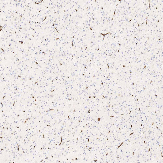 Immunohistochemistry analysis of paraffin-embedded human brain using GLUT-1 Polyclonal Antibody at dilution of 1:300.