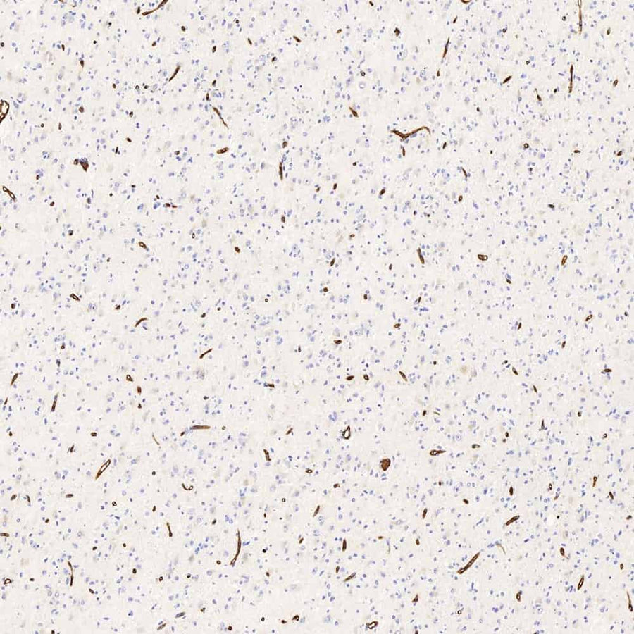 Immunohistochemistry analysis of paraffin-embedded human brain using GLUT-1 Polyclonal Antibody at dilution of 1:300.