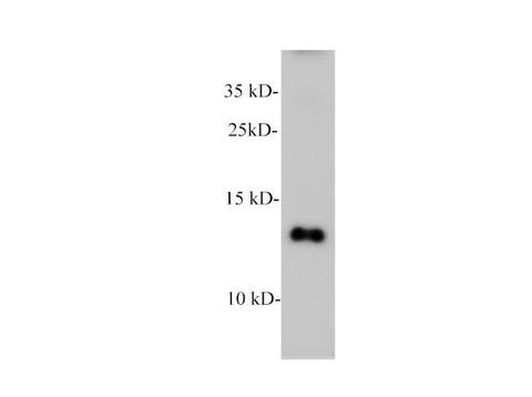 Western blot of Human plasma with CXCL4 polyclonal antibody at 1:1000 dilution.