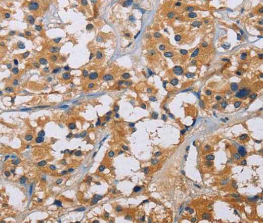 Anti-Human/Mouse NME5 Antibody