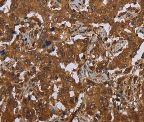 Anti-Human SCGB1D2 Antibody - ABMIUM