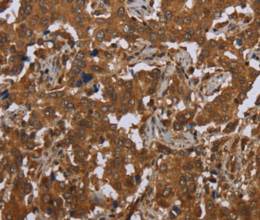 Anti-Human SCGB1D2 Antibody - ABMIUM