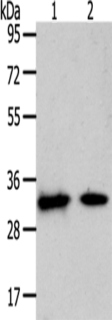 Anti-Human/Mouse/Rat SLC25A4 Antibody - ABMIUM