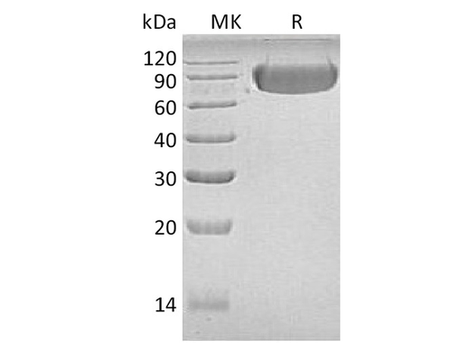 Recombinant Human LAG3/CD223 Protein (Fc Tag) - ABMIUM