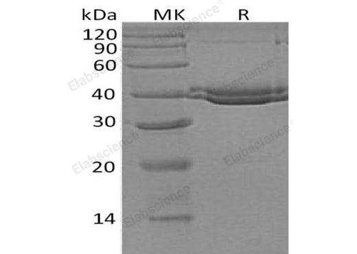 Recombinant Human SUMF1 Protein (His Tag) - ABMIUM
