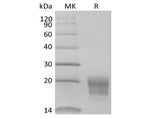 Recombinant Human IL-5 (C-6His-Avi) Biotinylated - ABMIUM
