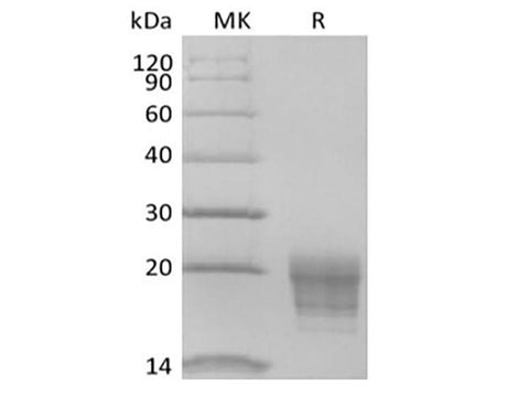 Recombinant Human IL-5 (C-6His-Avi) Biotinylated - ABMIUM