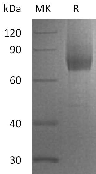 Recombinant Human IL7RA/CD127 Protein (Fc & His Tag) - ABMIUM