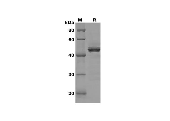SDS-PAGE analysis of Human ERG proteins, 2 μg/lane of Recombinant Human ERG proteins was resolved with SDS-PAGE under reducing conditions, showing bands at 46 kDa.