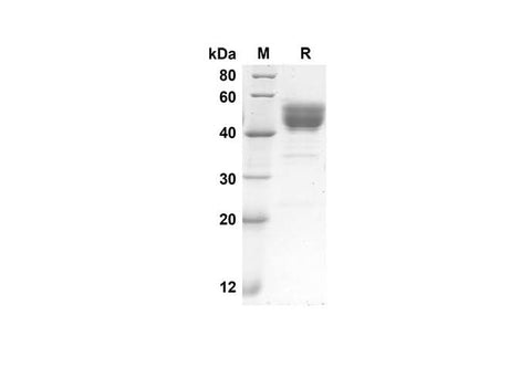 SDS-PAGE analysis of Human GM-CSF proteins, 2 μg/lane of Recombinant Human GM-CSF proteins was resolved with SDS-PAGE under reducing conditions, showing bands at 38.9 kDa.