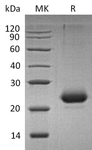 Recombinant Mouse CD40/TNFRSF5 Protein (His Tag) - ABMIUM