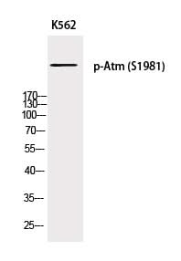 Western Blot analysis of K562 cells with Phospho-Atm (Ser1981) Polyclonal Antibody at dilution of 1:500