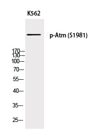 Western Blot analysis of K562 cells with Phospho-Atm (Ser1981) Polyclonal Antibody at dilution of 1:500