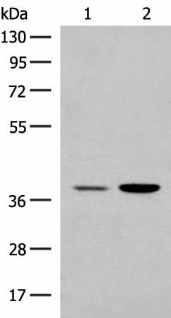 Western blot analysis of HEPG2 and K562 cell lysates using MRM1 Polyclonal Antibody at dilution of 1:400
