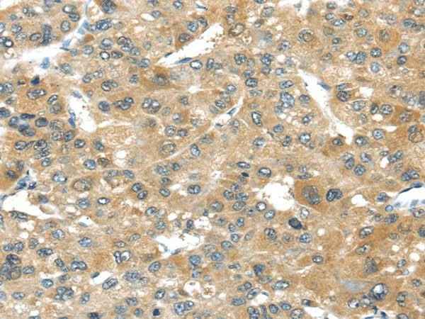 Anti-Human/Mouse TMPRSS4 Antibody