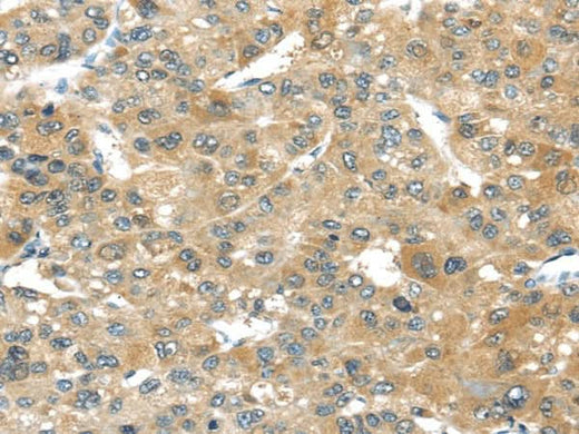 Anti-Human/Mouse TMPRSS4 Antibody - ABMIUM