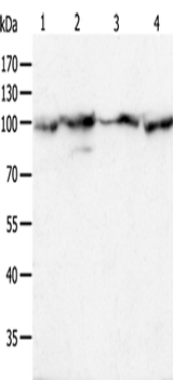 Anti-Human/Mouse/Rat HSP90B1 Antibody - ABMIUM