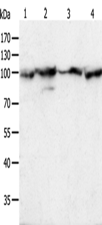 Anti-Human/Mouse/Rat HSP90B1 Antibody - ABMIUM