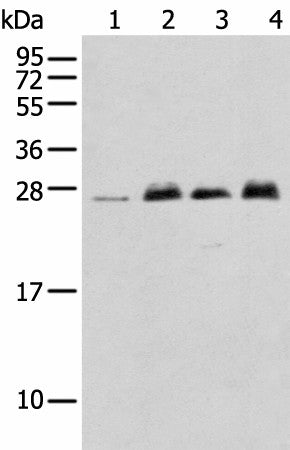 Western blot analysis of K-562 cell Mouse brain tissue Rat brain tissue Human fetal brain tissue using MOB4 Polyclonal Antibody at dilution of 1:400
