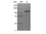 Recombinant Human LRRC32/GARP (C-Fc) - ABMIUM