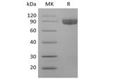 Recombinant Human Afamin/AFM (C-6His) - ABMIUM