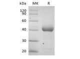 Recombinant Human Activin RIA/ALK-2 (C-Fc) - ABMIUM