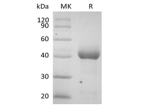 Recombinant Human Activin RIA/ALK-2 (C-Fc) - ABMIUM