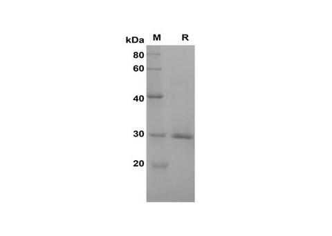 SDS-PAGE analysis of Rat CRP/C-Reactive proteins, 2 μg/lane of Recombinant Rat CRP/C-Reactive proteins was resolved with SDS-PAGE under reducing conditions, showing bands at 30 kDa.