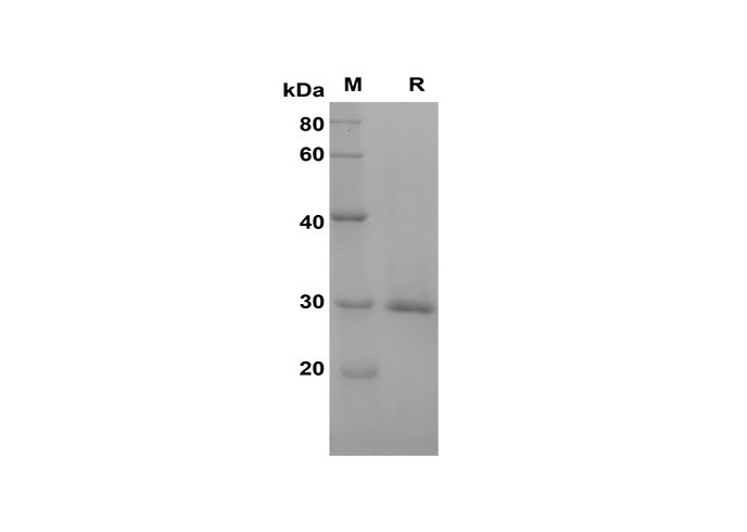 SDS-PAGE analysis of Rat CRP/C-Reactive proteins, 2 μg/lane of Recombinant Rat CRP/C-Reactive proteins was resolved with SDS-PAGE under reducing conditions, showing bands at 30 kDa.