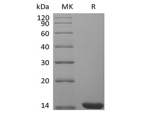 Recombinant Mouse Fibroblast Growth Factor 4/FGF-4 - ABMIUM