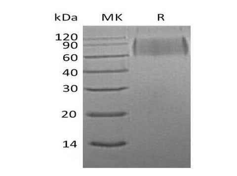 Recombinant Mouse SIRPA/CD172a Protein (His Tag) - ABMIUM