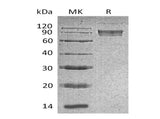 Recombinant Mouse B7-H4/VTCN1 Protein (Fc Tag) - ABMIUM