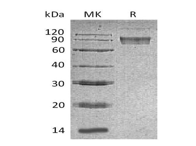 Recombinant Mouse B7-H4/VTCN1 Protein (Fc Tag) - ABMIUM
