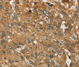 Anti-Human/Mouse RPS6KA2 Antibody - ABMIUM