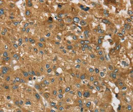 Anti-Human/Mouse RPS6KA2 Antibody