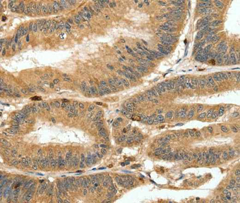 Anti-Human S100A4 Antibody