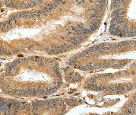 Anti-Human S100A4 Antibody