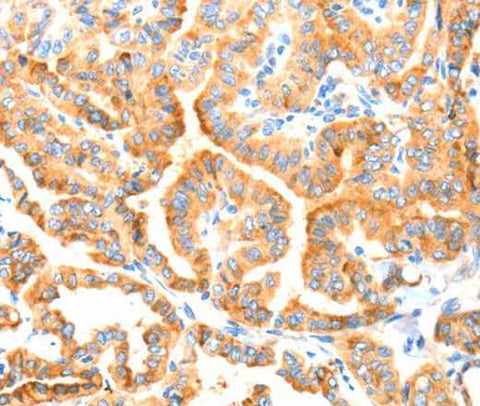 Anti-Human/Mouse/Rat MANF Antibody