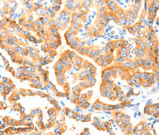 Anti-Human/Mouse/Rat MANF Antibody