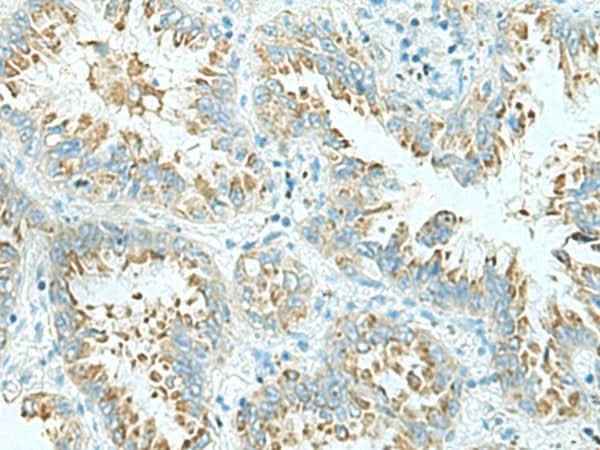 Anti-Human SHTN1 Antibody