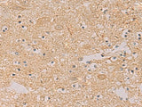 Immunohistochemistry of paraffin-embedded Human brain tissue using PTPRN Polyclonal Antibody at dilution of 1:55(×200)