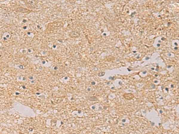 Anti-Human/Mouse/Rat PTPRN Antibody