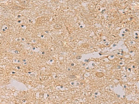 Immunohistochemistry of paraffin-embedded Human brain tissue using PTPRN Polyclonal Antibody at dilution of 1:55(×200)
