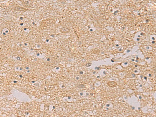 Immunohistochemistry of paraffin-embedded Human brain tissue using PTPRN Polyclonal Antibody at dilution of 1:55(×200)