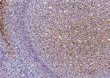 Anti-Human CSTA Antibody [A1029] - ABMIUM