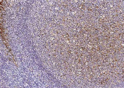 Anti-Human CSTA Antibody [A1029] - ABMIUM